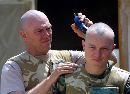 army hair transplant